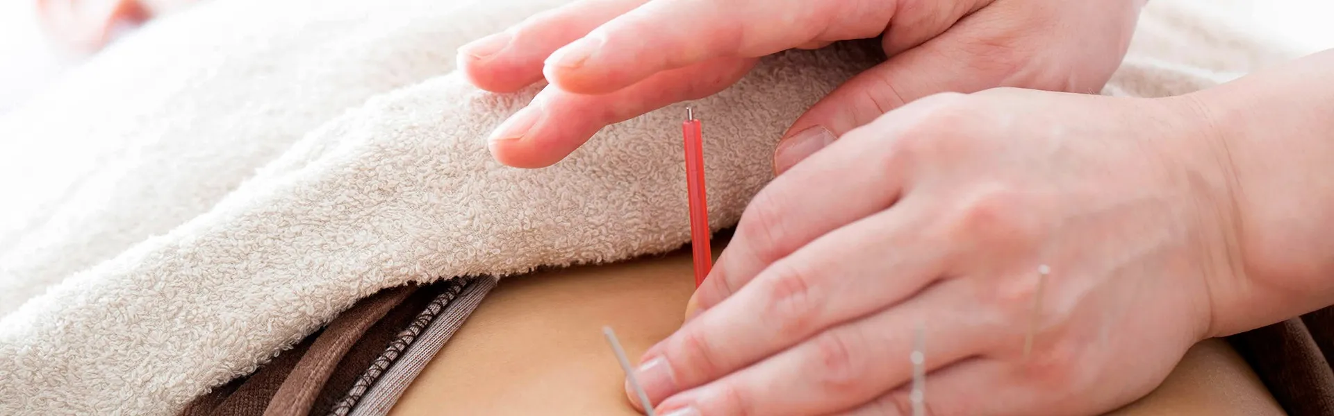 難波で鍼灸の効果を体感：難波の優鍼堂コラム